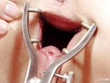 sweet blonde gaping her shaved vagina with a metal speculum